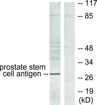 Anti-Prostate Stem Cell Antigen antibody produced in rabbit affinity isolated antibody