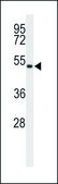 ANTI-ASMT (CENTER) antibody produced in rabbit IgG fraction of antiserum, buffered aqueous solution