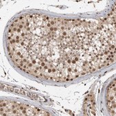 Anti-CBLL1 antibody produced in rabbit Prestige Antibodies® Powered by Atlas Antibodies, affinity isolated antibody, buffered aqueous glycerol solution, Ab2