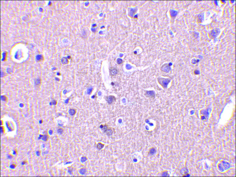 Anti-CRMP1 antibody produced in rabbit affinity isolated antibody, buffered aqueous solution