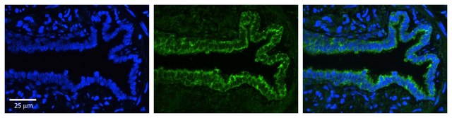 Anti-SerPINE1 (AB1) antibody produced in rabbit affinity isolated antibody