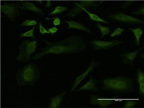 ANTI-ULK2 antibody produced in mouse clone 2A12, purified immunoglobulin, buffered aqueous solution