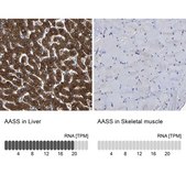 抗-AASS 兔抗 Prestige Antibodies® Powered by Atlas Antibodies, affinity isolated antibody, buffered aqueous glycerol solution, Ab3