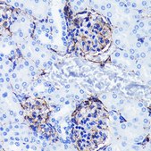 Anti- Vimentin antibody produced in rabbit