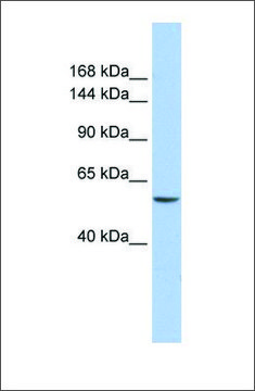 Anti-CHD2 antibody produced in rabbit affinity isolated antibody