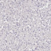 Anti-NUTM1 antibody produced in rabbit Prestige Antibodies® Powered by Atlas Antibodies, affinity isolated antibody, buffered aqueous glycerol solution