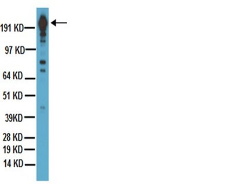 Anti-DYKDDDDK (FLAG&#174; epitope tag) Antibody, clone 2EL-1B11 ascites fluid, clone 2EL-1B11, Chemicon&#174;