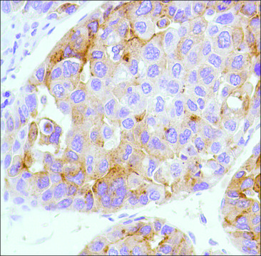 Anti-Alpha-Fetoprotein antibody, Rabbit monoclonal recombinant, expressed in proprietary host, clone SP154, affinity isolated antibody