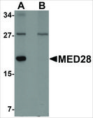 Anti-MED28 antibody produced in rabbit affinity isolated antibody, buffered aqueous solution
