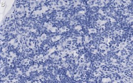 Anti-CD8β Antibody, clone 1H21 ZooMAb® Rabbit Monoclonal recombinant, expressed in HEK 293 cells