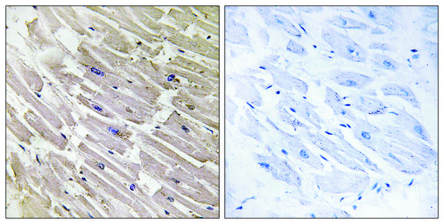 Anti-MRPL16 antibody produced in rabbit affinity isolated antibody