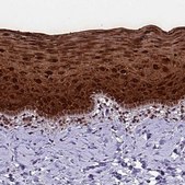 Anti-KRT6A antibody produced in rabbit Prestige Antibodies® Powered by Atlas Antibodies, affinity isolated antibody, buffered aqueous glycerol solution