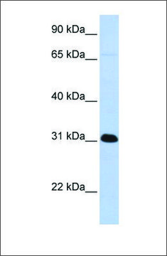 Anti-PADI4 antibody produced in rabbit affinity isolated antibody