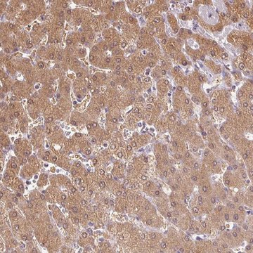 Anti-DGUOK antibody produced in rabbit Prestige Antibodies&#174; Powered by Atlas Antibodies, affinity isolated antibody, buffered aqueous glycerol solution