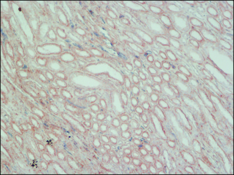 Monoclonal Anti-HAVCR1 antibody produced in mouse clone KM-23, purified from hybridoma cell culture