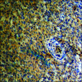 Anti-phospho-Estrogen Receptor-? (pSer87) antibody produced in rabbit affinity isolated antibody