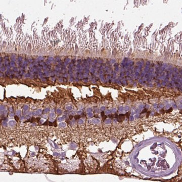 Anti-CRABP1 antibody produced in rabbit Prestige Antibodies&#174; Powered by Atlas Antibodies, affinity isolated antibody, buffered aqueous glycerol solution