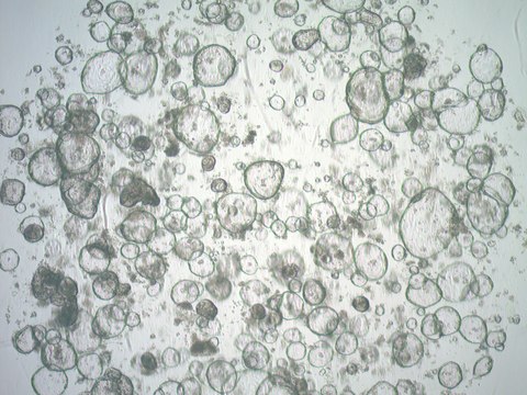 3dGRO Colon Intestinal Organoids, Age 63 (Prep ht-103-C)