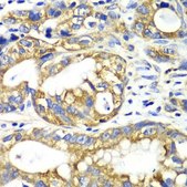 Anti-AK2 antibody produced in rabbit