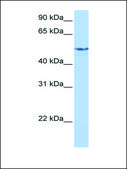Anti-CRAT antibody produced in rabbit affinity isolated antibody