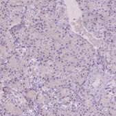 Anti-A4GNT antibody produced in rabbit Prestige Antibodies® Powered by Atlas Antibodies, affinity isolated antibody, buffered aqueous glycerol solution