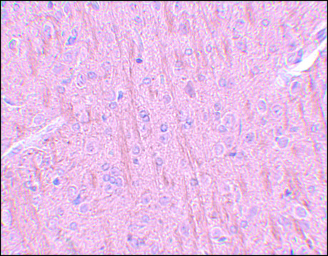 Anti-CCDC106 antibody produced in rabbit affinity isolated antibody, buffered aqueous solution