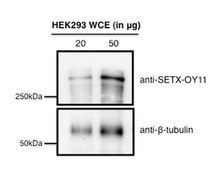 Anti-Senataxin (OY11) Antibody from rabbit, purified by affinity chromatography