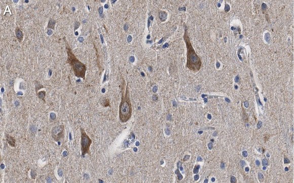 Anti-TOMM20 Antibody, clone 5H22 ZooMAb&#174; Rabbit Monoclonal recombinant, expressed in HEK 293 cells