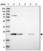 Anti-PSMB6 antibody produced in rabbit Prestige Antibodies® Powered by Atlas Antibodies, affinity isolated antibody, buffered aqueous glycerol solution