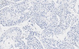 Anti-FKBP52 Antibody, clone 4H21 ZooMAb® Rabbit Monoclonal recombinant, expressed in HEK 293 cells