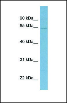 Anti-EYA1 antibody produced in rabbit affinity isolated antibody