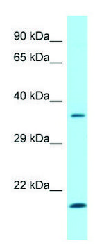 Anti-SGTA (C-terminal) antibody produced in rabbit affinity isolated antibody