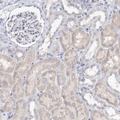 Anti-KIAA1109 antibody produced in rabbit Prestige Antibodies® Powered by Atlas Antibodies, affinity isolated antibody, buffered aqueous glycerol solution