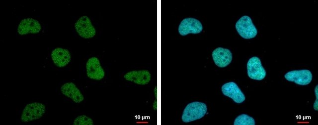 Monoclonal Anti-STAG1 antibody produced in mouse clone GT8810, affinity isolated antibody