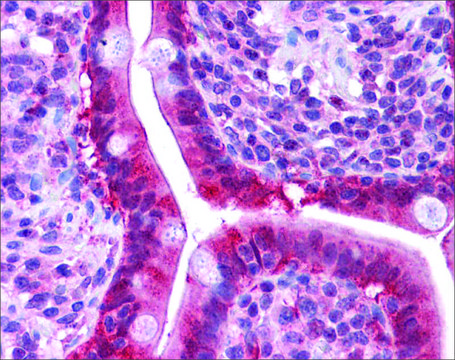 Anti-LGALS3 antibody produced in rabbit affinity isolated antibody