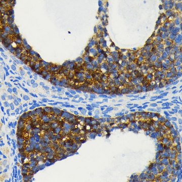 Anti-cIAP1 antibody produced in rabbit