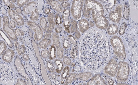 Anti-FADD Antibody, clone 11N7, ZooMAb&#174; Rabbit Monoclonal recombinant, expressed in HEK 293 cells