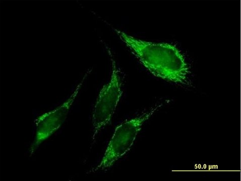 Anti-PNPT1 antibody produced in mouse purified immunoglobulin, buffered aqueous solution