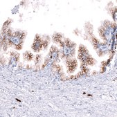 Monoclonal Anti-CD38 antibody produced in mouse Prestige Antibodies® Powered by Atlas Antibodies, clone CL15572, purified antibody (Protein A)