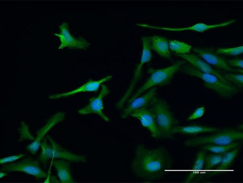 Anti-PSME1 antibody produced in rabbit purified immunoglobulin, buffered aqueous solution