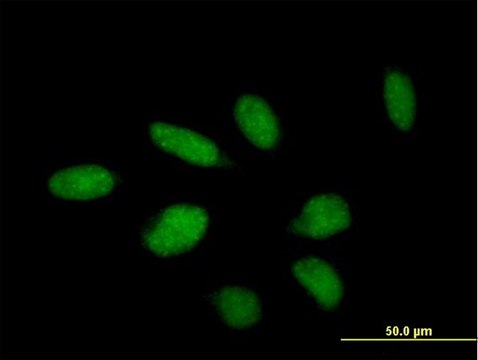 Anti-TTC23 antibody produced in mouse purified immunoglobulin, buffered aqueous solution