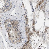 Anti-ERGIC3 antibody produced in rabbit Prestige Antibodies® Powered by Atlas Antibodies, affinity isolated antibody, buffered aqueous glycerol solution