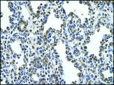 Anti-PANX1 affinity isolated antibody