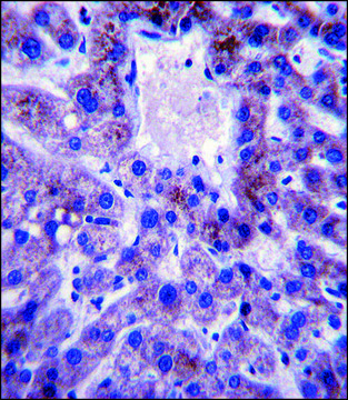 ANTI-UBE2W (C-TERM) antibody produced in rabbit IgG fraction of antiserum, buffered aqueous solution