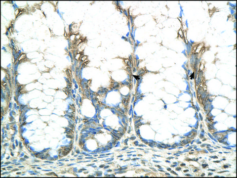 Anti-CHIC2 antibody produced in rabbit affinity isolated antibody