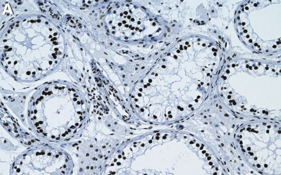 Anti-Ub-Histone H2A-Lys119 Antibody, clone 8B21 ZooMAb&#174; Rabbit Monoclonal recombinant, expressed in HEK 293 cells