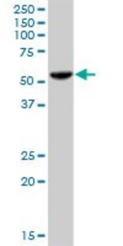 Anti-PHGDH antibody produced in mouse purified immunoglobulin, buffered aqueous solution