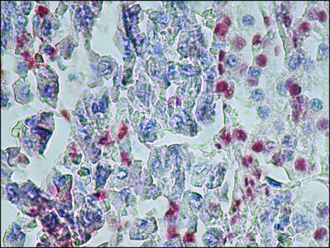 Anti-MR-Pro ADM antibody, Mouse monoclonal clone MR2.1, purified from hybridoma cell culture