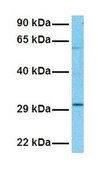 Anti-NNMT antibody produced in rabbit IgG fraction of antiserum