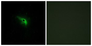 Anti-TPIP1, antibody produced in rabbit affinity isolated antibody
